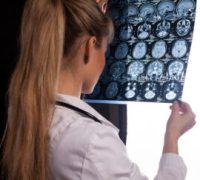 Back view of a doctor woman in white labcoat looking through mri of a human brain computed tomography